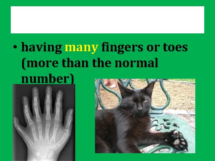  • having many fingers or toes (more than the normal number) 