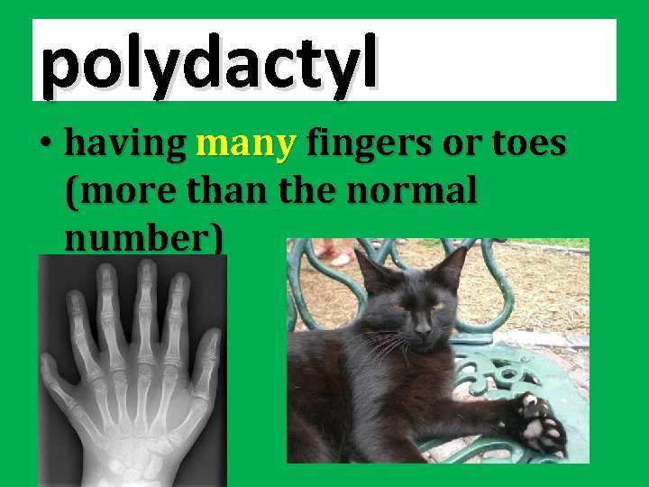 polydactyl • having many fingers or toes (more than the normal number) 