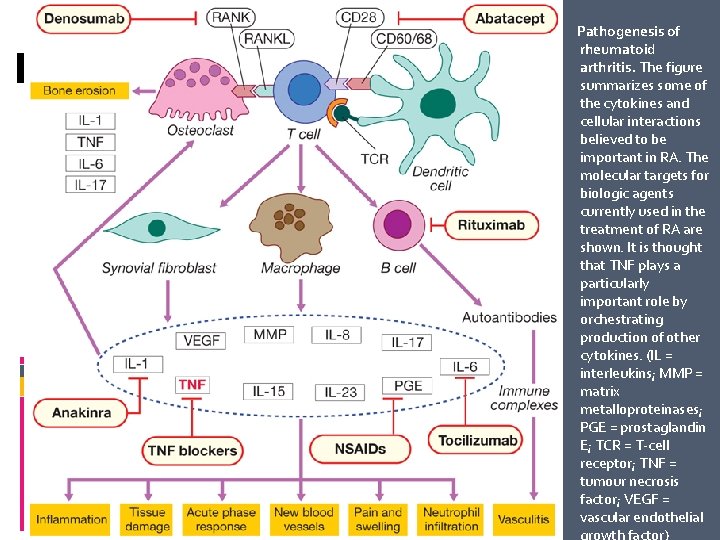 The progression of Rheumatoid Arthritis Pathogenesis of rheumatoid arthritis. The figure summarizes some of