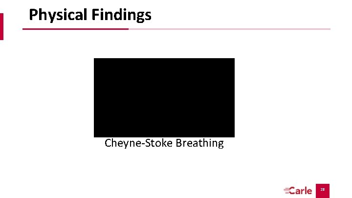 Physical Findings Cheyne-Stoke Breathing 28 Physical Findings Cheyne-Stoke Breathing 28