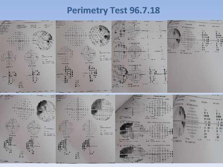 Perimetry Test 96. 7. 18 