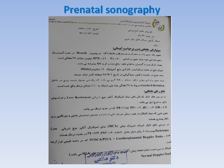 Prenatal sonography 