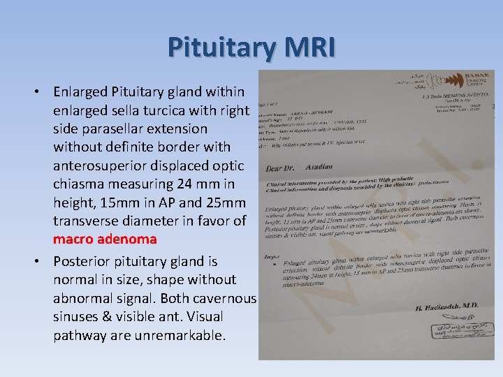 Pituitary MRI • Enlarged Pituitary gland within enlarged sella turcica with right side parasellar