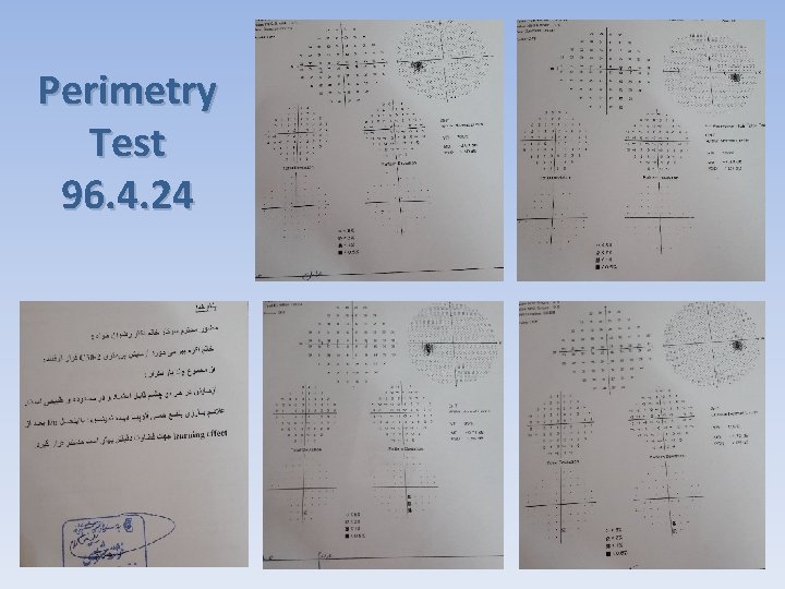 Perimetry Test 96. 4. 24 