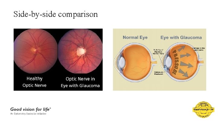 Side-by-side comparison 