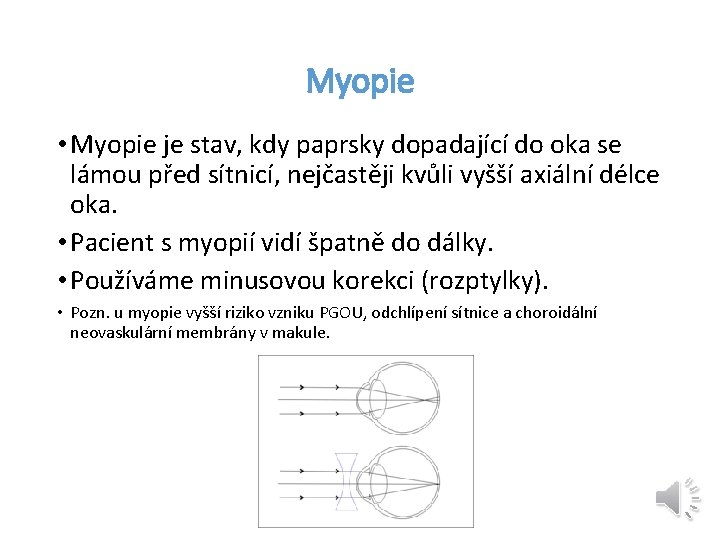 Myopie • Myopie je stav, kdy paprsky dopadající do oka se lámou před sítnicí,