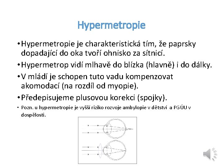 Hypermetropie • Hypermetropie je charakteristická tím, že paprsky dopadající do oka tvoří ohnisko za