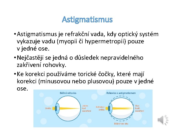 Astigmatismus • Astigmatismus je refrakční vada, kdy optický systém vykazuje vadu (myopii či hypermetropii)