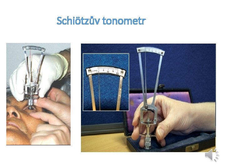 Schiötzův tonometr 