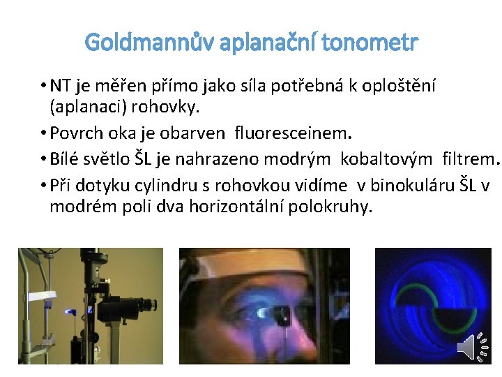 Goldmannův aplanační tonometr • NT je měřen přímo jako síla potřebná k oploštění (aplanaci)