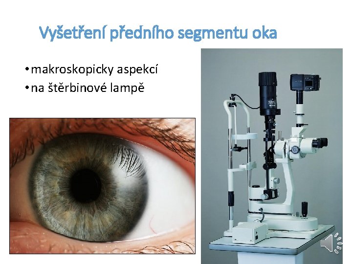 Vyšetření předního segmentu oka • makroskopicky aspekcí • na štěrbinové lampě 