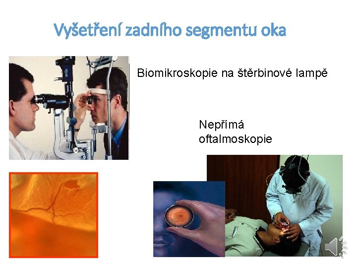 Vyšetření zadního segmentu oka Biomikroskopie na štěrbinové lampě Nepřímá oftalmoskopie 