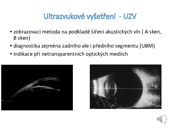 Ultrazvukové vyšetření - UZV • zobrazovací metoda na podkladě šíření akustických vln ( A