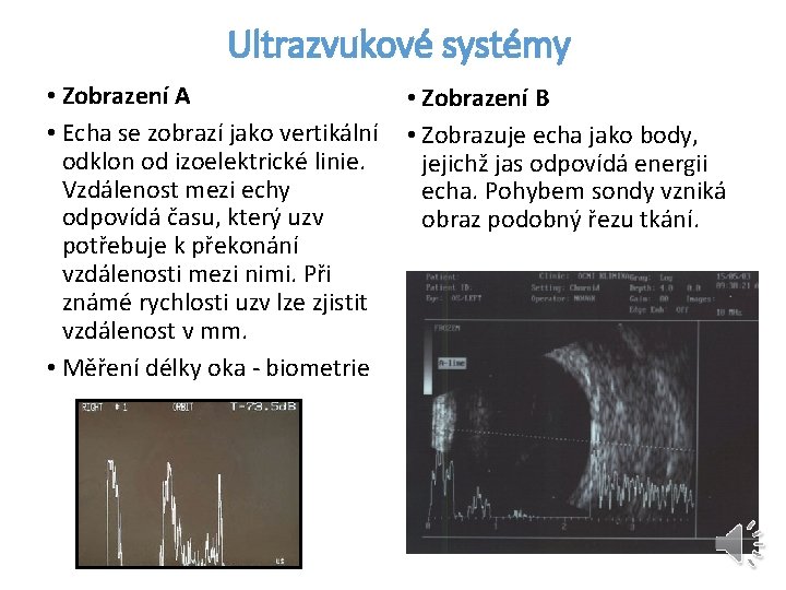 Ultrazvukové systémy • Zobrazení A • Echa se zobrazí jako vertikální odklon od izoelektrické