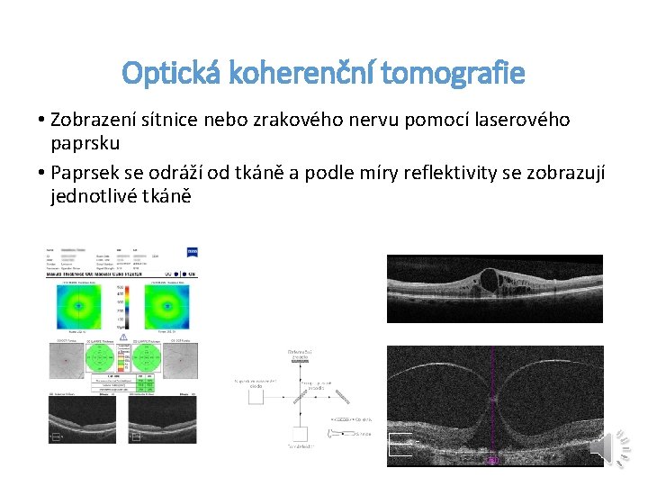 Optická koherenční tomografie • Zobrazení sítnice nebo zrakového nervu pomocí laserového paprsku • Paprsek