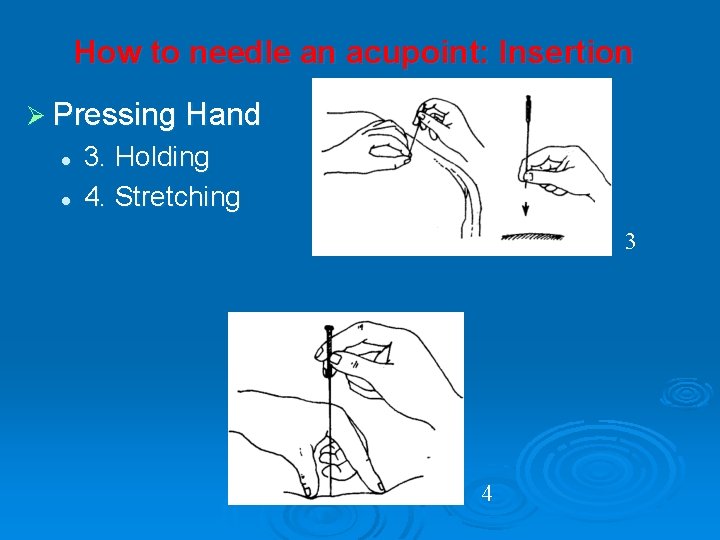 How to needle an acupoint: Insertion Ø Pressing Hand l l 3. Holding 4.