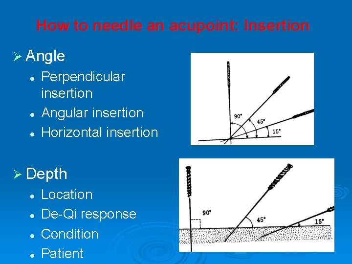 How to needle an acupoint: Insertion Ø Angle l l l Perpendicular insertion Angular