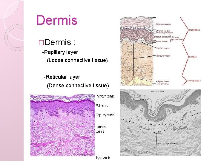 Dermis �Dermis : -Papillary layer (Loose connective tissue) -Reticular layer (Dense connective tissue) 
