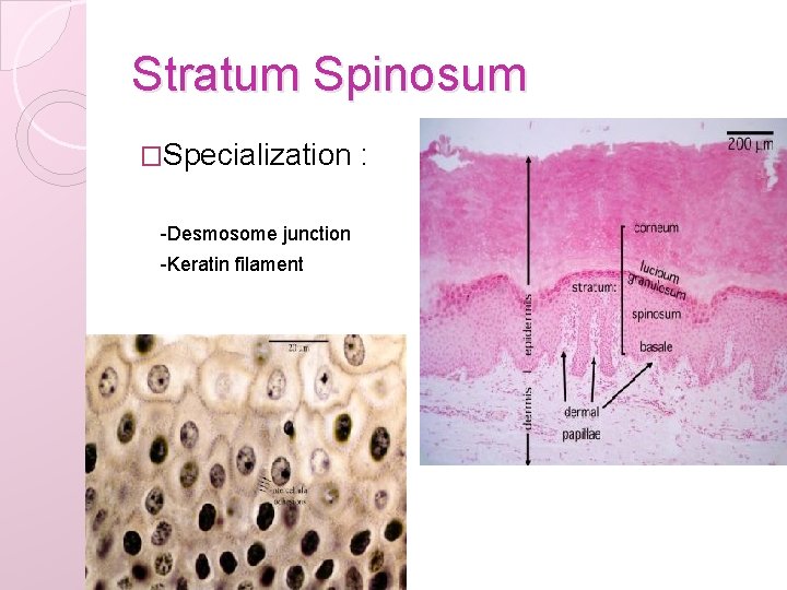 Stratum Spinosum �Specialization -Desmosome junction -Keratin filament : 