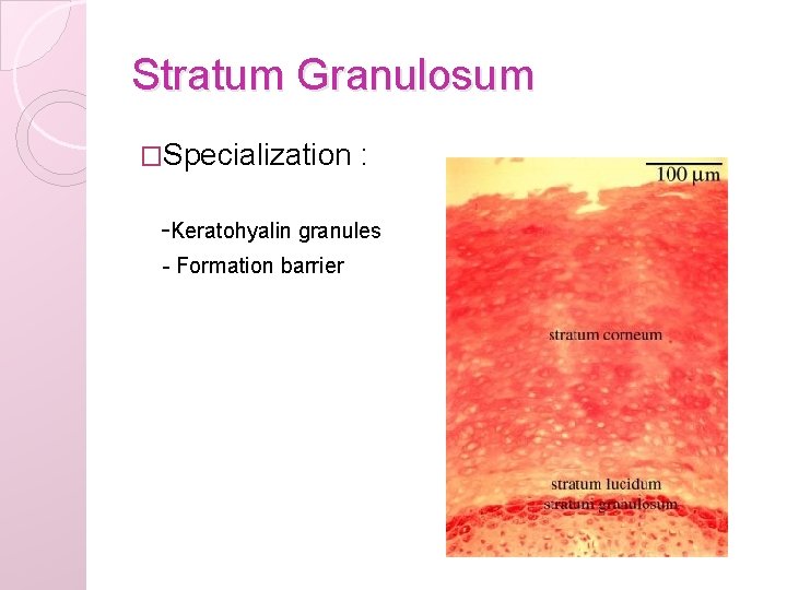 Stratum Granulosum �Specialization : -Keratohyalin granules - Formation barrier 