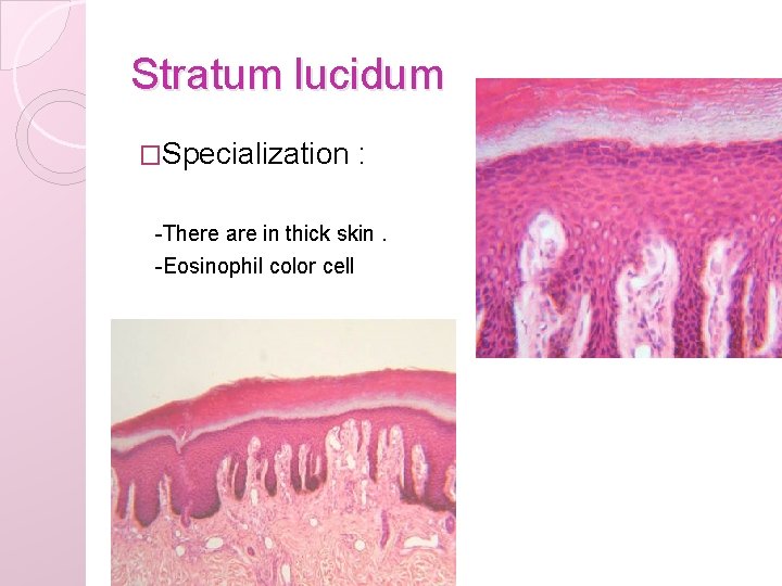 Stratum lucidum �Specialization : -There are in thick skin. -Eosinophil color cell 