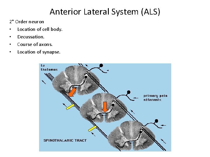 Anterior Lateral System (ALS) 2° Order neuron • Location of cell body. • Decussation.