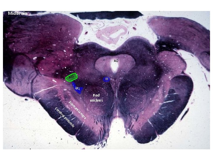 Midbrain AQ III ALS ML bs Su Red nucleus ia nt ta a gr