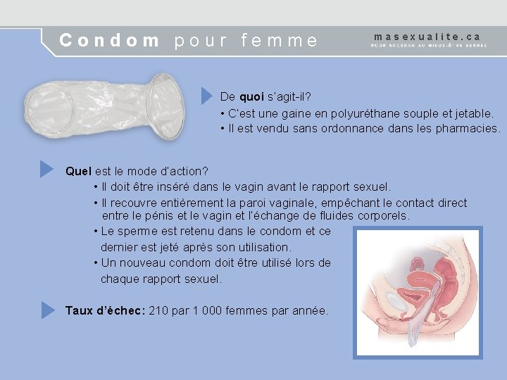 Condom pour femme masexualite. ca De quoi s’agit-il? • C’est une gaine en polyuréthane