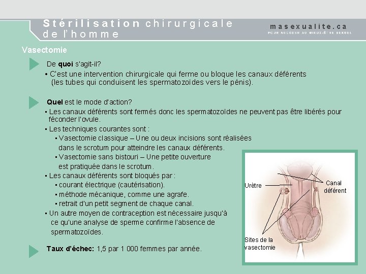 Stérilisation chirurgicale d e l’ h o m m e masexualite. ca Vasectomie De