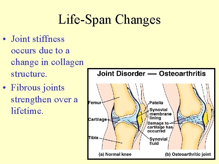 Life-Span Changes • Joint stiffness occurs due to a change in collagen structure. •