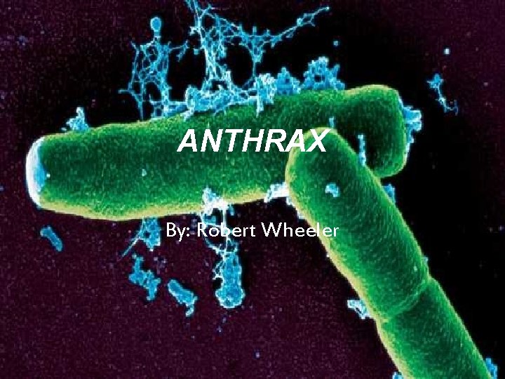 ANTHRAX By: Robert Wheeler 