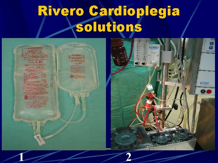 Rivero Cardioplegia solutions 1 2 