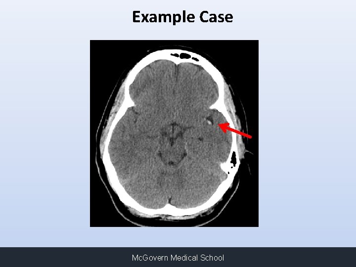 Example Case Mc. Govern Medical School 