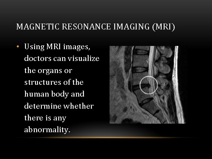 MAGNETIC RESONANCE IMAGING (MRI) • Using MRI images, doctors can visualize the organs or