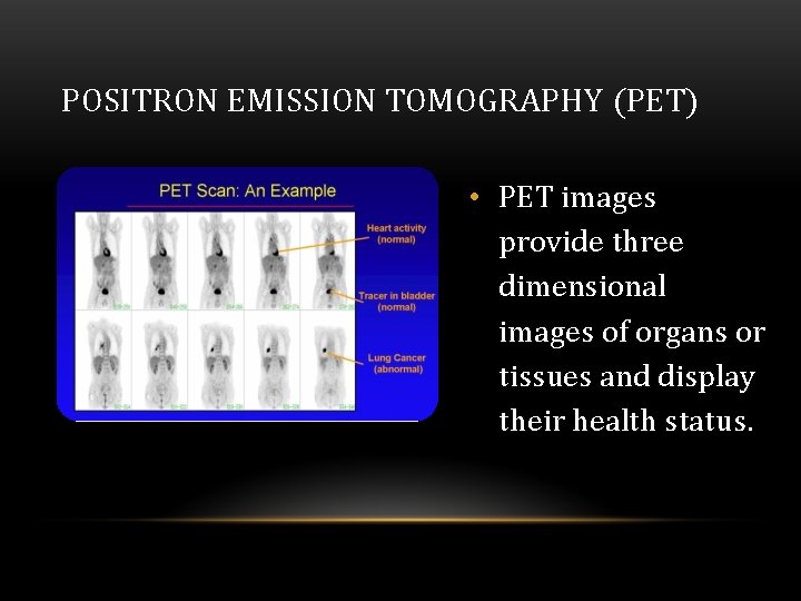 POSITRON EMISSION TOMOGRAPHY (PET) • PET images provide three dimensional images of organs or