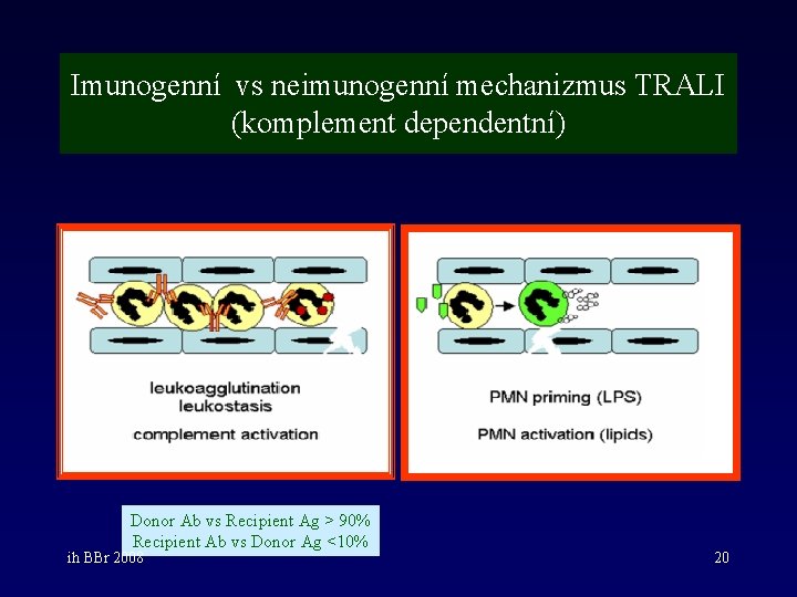 Imunogenní vs neimunogenní mechanizmus TRALI (komplement dependentní) Donor Ab vs Recipient Ag > 90%