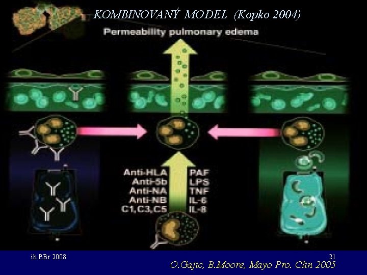 KOMBINOVANÝ MODEL (Kopko 2004) ih BBr 2008 21 O. Gajic, B. Moore, Mayo Pro.