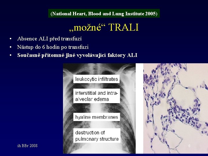 (National Heart, Blood and Lung Institute 2005) „možné“ TRALI • Absence ALI před transfuzí