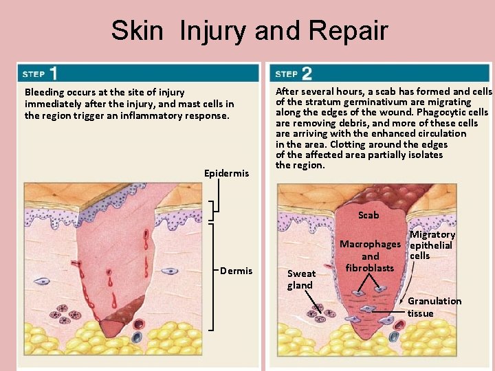 Skin Injury and Repair Bleeding occurs at the site of injury immediately after the Skin Injury and Repair Bleeding occurs at the site of injury immediately after the