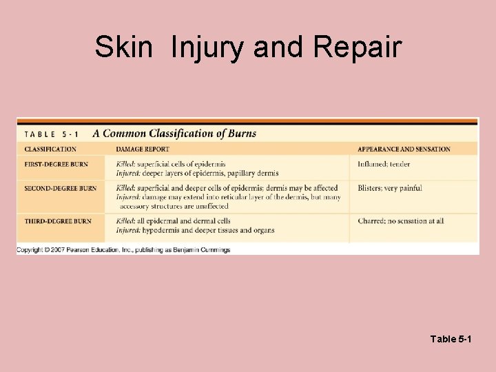 Skin Injury and Repair Table 5 -1 Skin Injury and Repair Table 5 -1