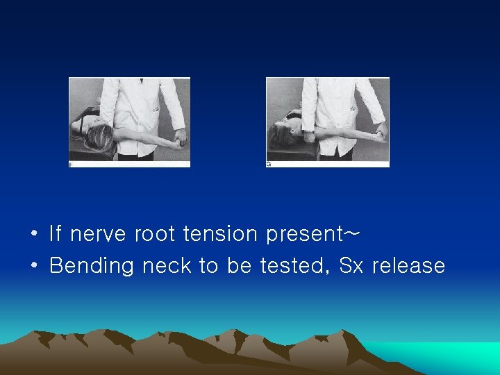  • If nerve root tension present~ • Bending neck to be tested, Sx