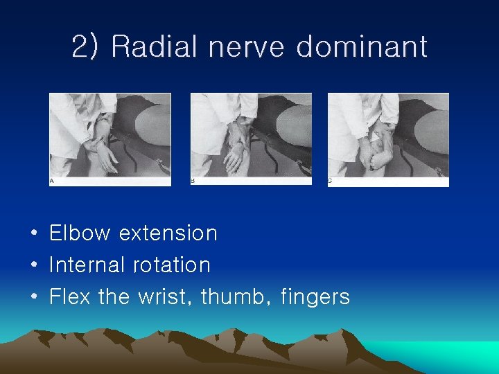 2) Radial nerve dominant • Elbow extension • Internal rotation • Flex the wrist,