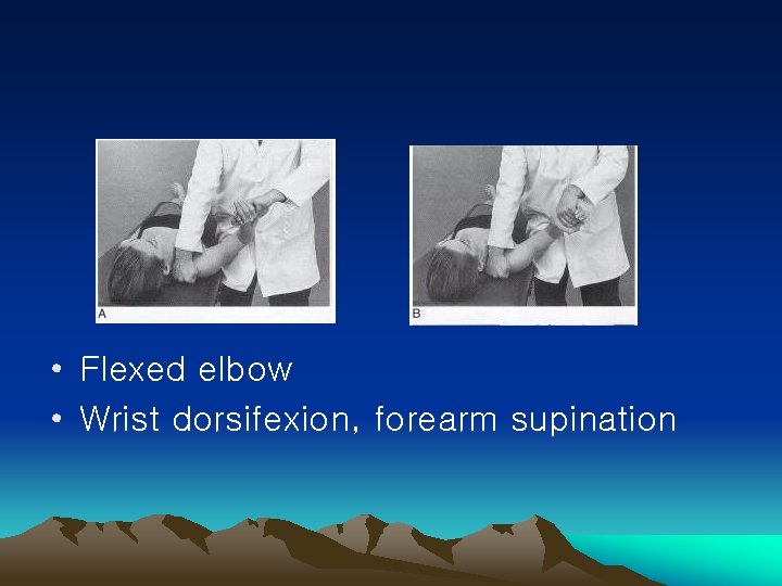  • Flexed elbow • Wrist dorsifexion, forearm supination 