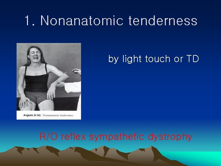 1. Nonanatomic tenderness by light touch or TD R/O reflex sympathetic dystrophy 