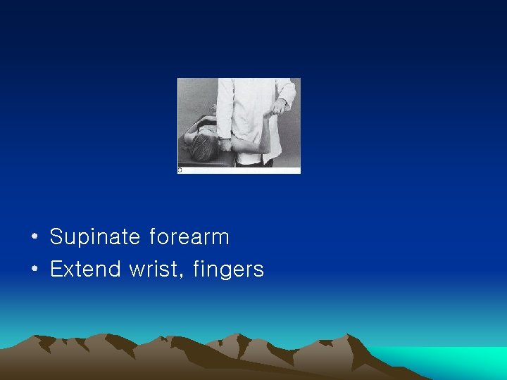  • Supinate forearm • Extend wrist, fingers 