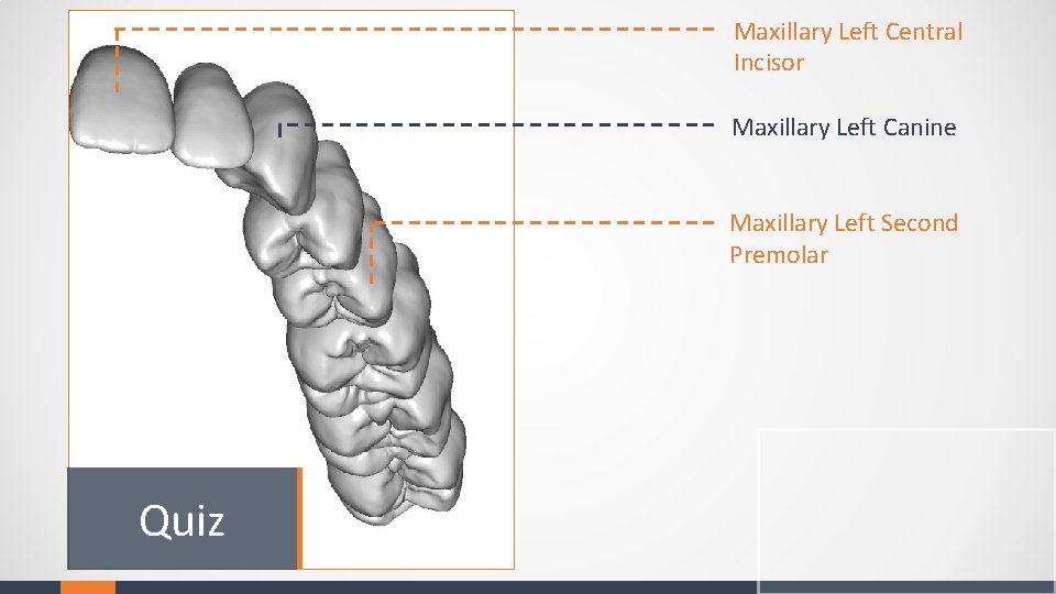 Maxillary Left Central Incisor Maxillary Left Canine Maxillary Left Second Premolar Quiz 