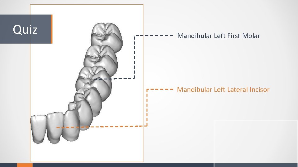 Quiz Mandibular Left First Molar Mandibular Left Lateral Incisor 