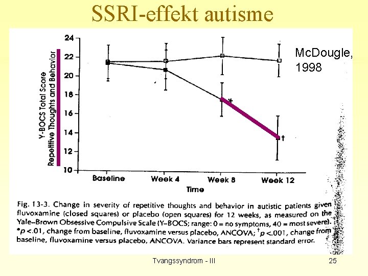 SSRI-effekt autisme Mc. Dougle, 1998 Tvangssyndrom - III 25 