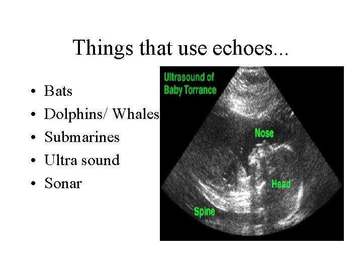 Things that use echoes. . . • • • Bats Dolphins/ Whales Submarines Ultra
