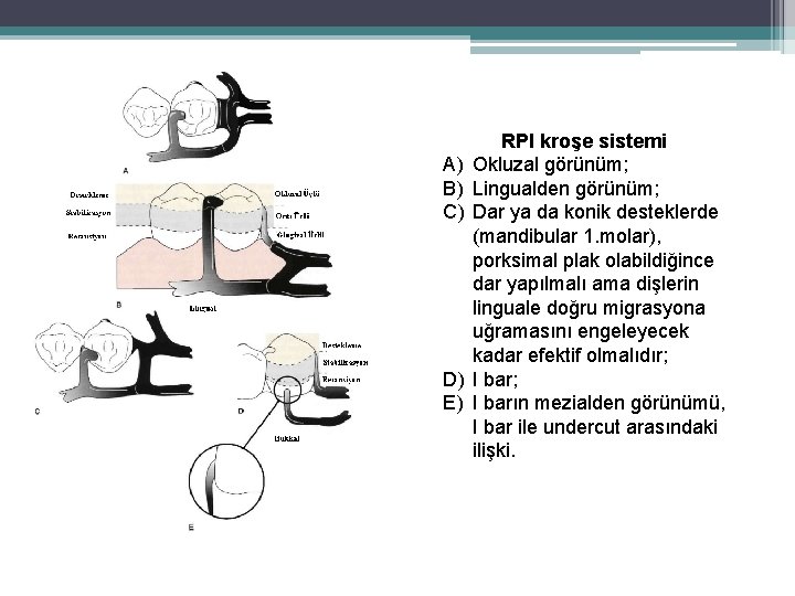 A) B) C) D) E) RPI kroşe sistemi Okluzal görünüm; Lingualden görünüm; Dar ya